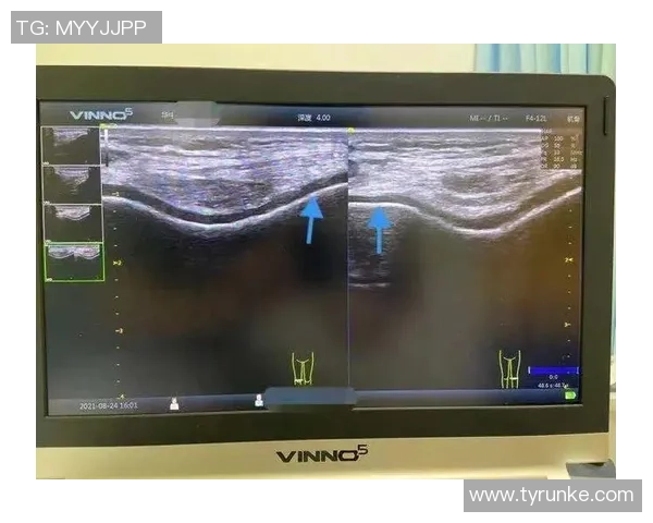 足球明星膝关节受伤的原因与康复之路探讨